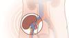 Clinical Kidney, Pancreas and Islet Transplantation