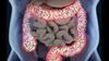 Nutrition and Health: Human Microbiome