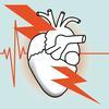 Myocardial Infarction