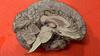 Understanding the Brain: The Neurobiology of Everyday Life